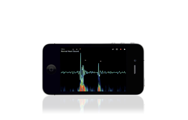 $10 Million X Prize Aims to Realize 'Star Trek' Medical Tricorder